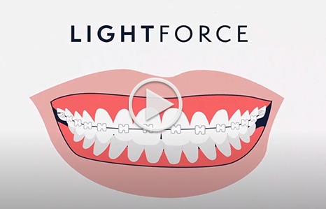 Lightforce Chatham Orthodontics in Chatham, NJ
